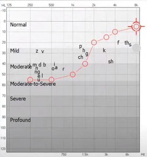 understand your hearing loss audiogram