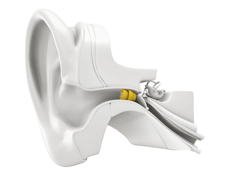Phonak Lyric: The Truly Invisible Hearing Aid

