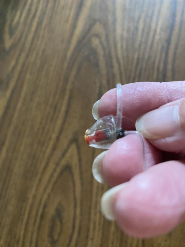 Hearing Aid Earlobe Issues: Slipping, Comfort, and Solutions - Hearing ...