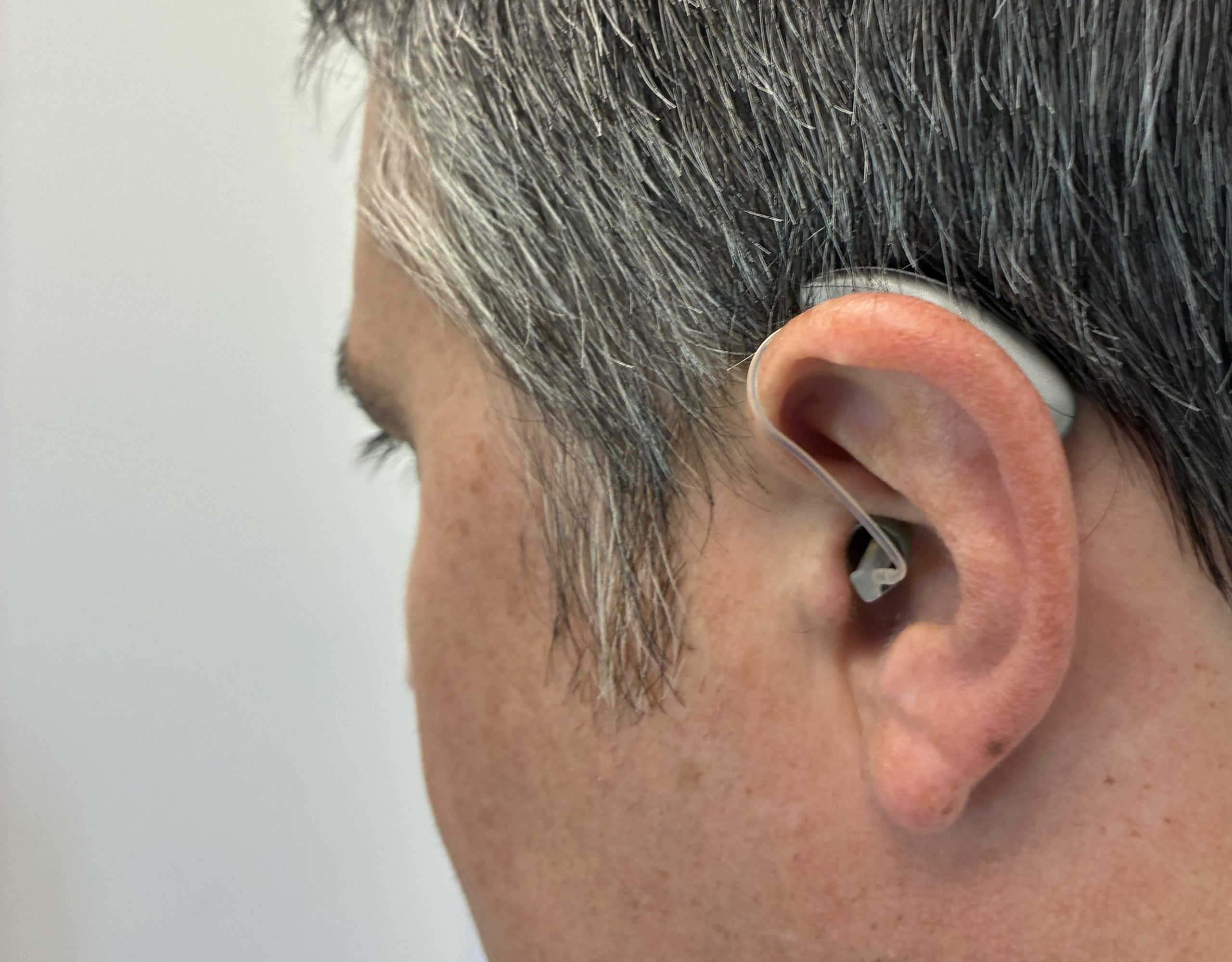 Hearing aid dome falling and slipping out of ear canal